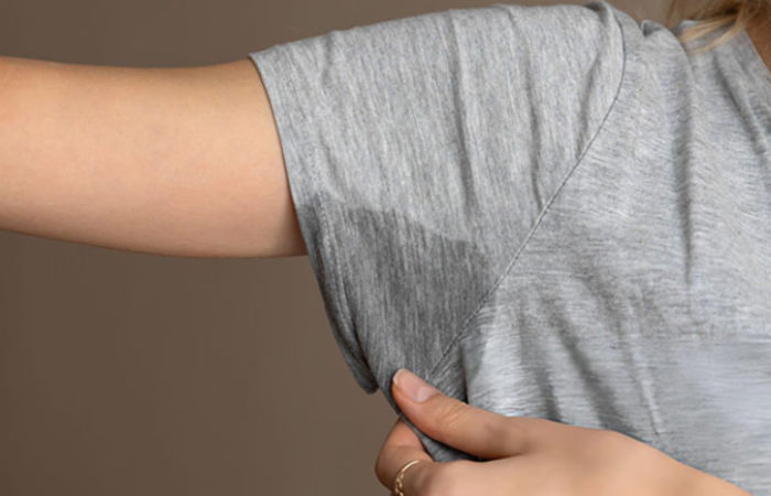 Hyperhidrosis Dermatologist